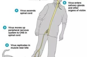 人犬病的症状及预防措施（人犬病的传播途径及病理变化）