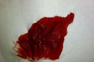 了解小狗胃出血的症状与表现（如何判断小狗是否患有胃出血）