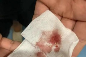 公猫膀胱结石康复之路（了解膀胱结石的猫咪康复需要多久？）