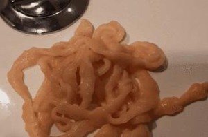 金毛肚子为何常有绦虫？（了解金毛肚子绦虫的原因和预防方法）