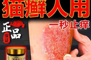 以人得了猫癣应该注意哪些（预防和治疗猫癣的有效方法及注意事项）