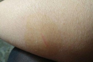 狗接种脱敏针的最佳时机（了解狗接种脱敏针的时间窗口和注意事项）