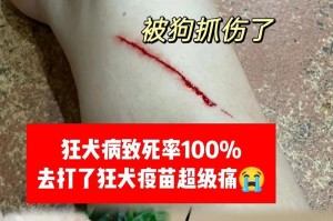 狗咬人的时间有多久？（揭秘狗咬人的持续时间及关键因素）
