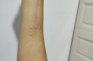 狗狗过敏的原因（了解引起狗狗过敏的因素及预防方法）