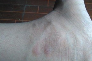 小狗胃肠炎的症状及治疗方法（了解小狗胃肠炎，保护它们的健康）