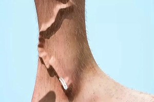 寄生虫危害人体健康，选择什么药物最有效？（除寄生虫，拯救身体健康，了解这些药物是关键！）
