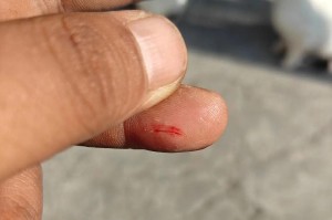 猫咬人下狠口，何必打死？（保护人类与猫的和谐共处）